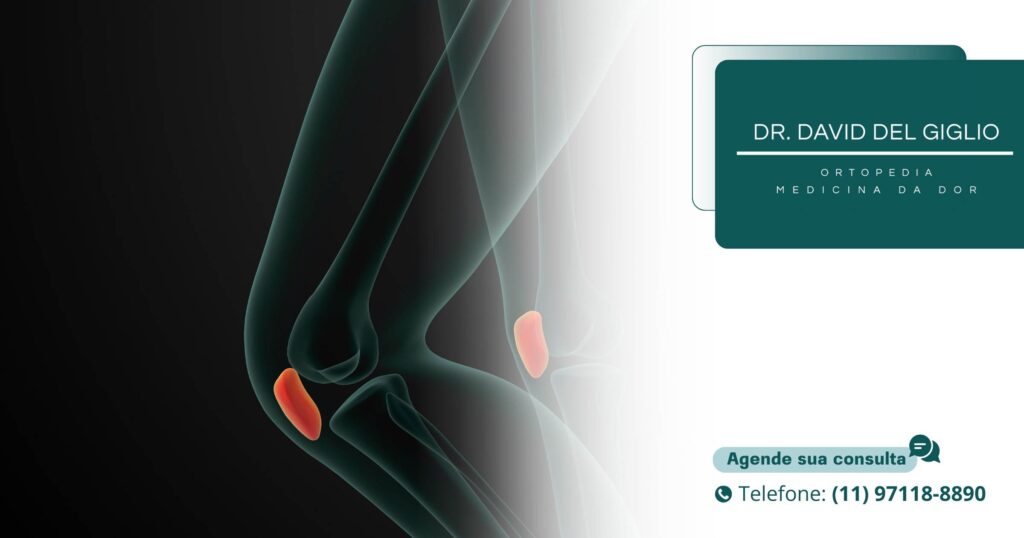 Condromalácia Patelar: O Que Causa a Dor na Parte da Frente do Joelho, Como Identificar e os Tratamentos Eficazes.