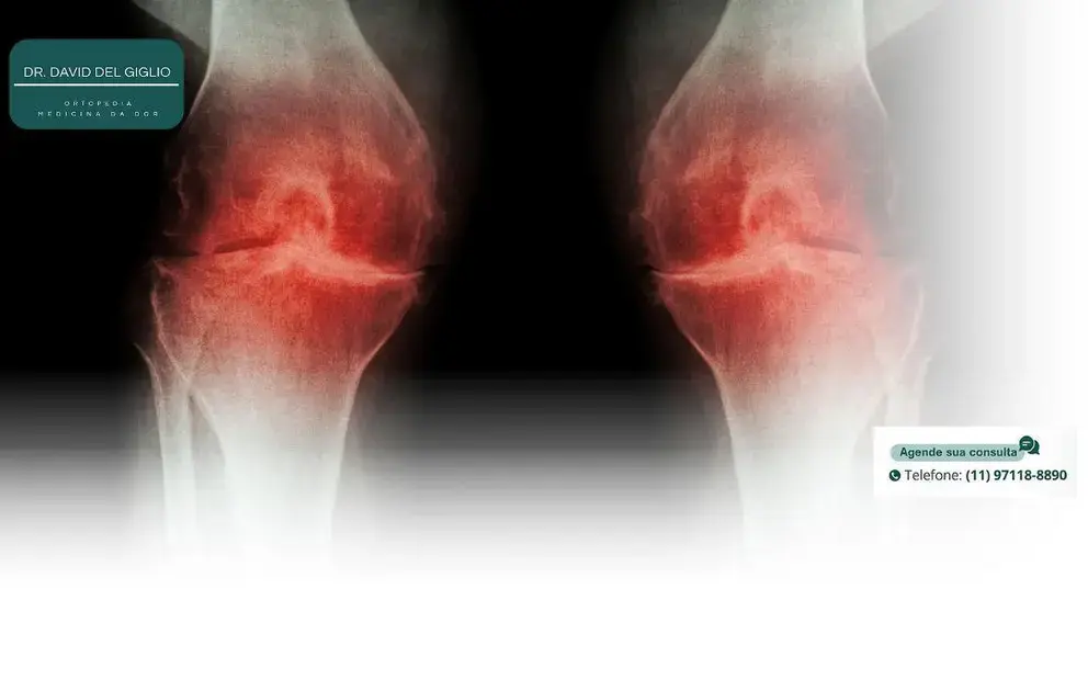 Medicina regenerativa para artrose no joelho: Entenda